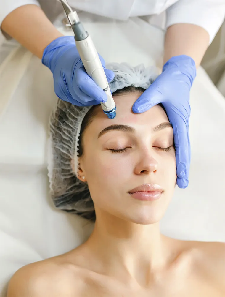 Aplicación de plasmaláser